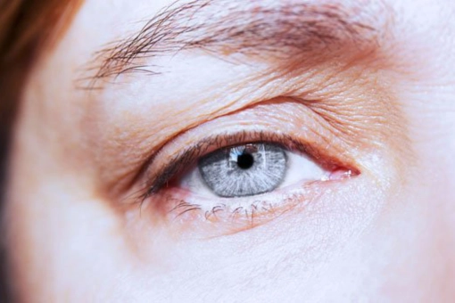 ¿Tu mirada luce cansada o apagada por el párpado caído?