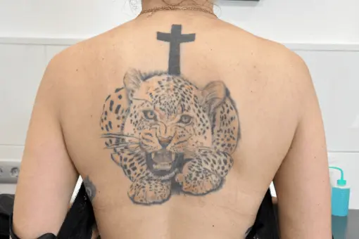 ¿Te avergüenza algún tatuaje mal realizado o simplemente ya no va con tu estilo actual?